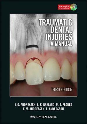 Traumatic Dental Injuries: A Manual, 3e - a49cd65d43bc41bf09668efc8477c6a8