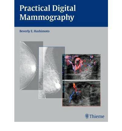 Practical Digital Mammography - a4c5f30d33232f0be7c4a49b56e87027