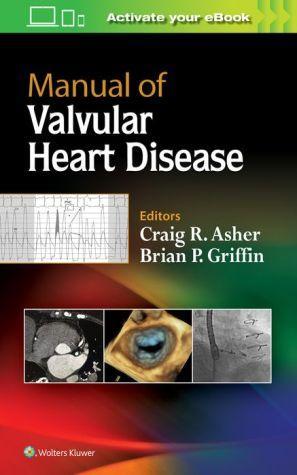 Manual of Valvular Heart Disease - ad5171b867a1f963bbac7b48768caa0e