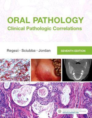 Oral Pathology, Clinical Pathologic Correlations, 7th Edition - b0b7f87516bd3e4570dadacaf399d0b4