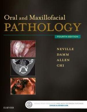 Oral and Maxillofacial Pathology, 4th Edition - b118d8dedaaebdbd3d2f6f9cd8566925