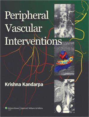 Peripheral Vascular Interventions ** - b470fcffb77e18239ed0d201dc06a483