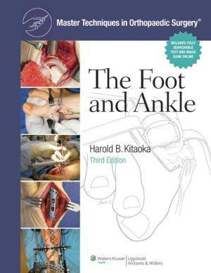 Master Techniques in Orthopaedic Surgery: The Foot and Ankle, 3e - b87975c08a313fccd51b7abfaa2b5cd0
