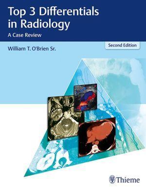 Top 3 Differentials in Radiology - A Case Review, 2E - b9e6e0dcd8b4de0041f2809fdbd49e75