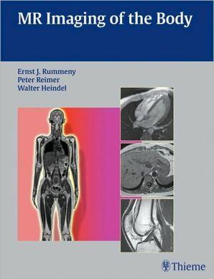 MR Imaging of the Body - bad042e91fe24981d6732ec941a868b5