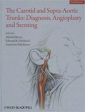 The Carotid and Supra-Aortic Trunks: Diagnosis, Angioplasty and Stenting - bb10b8a6e1a3570163db60f74a56aee4