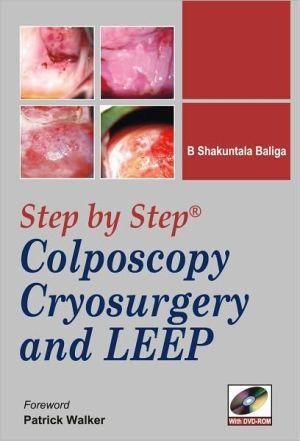 Step-By-Step Colposcopy, Cryosurgery and Leep ** - bb2b3d69c6aef6d987f5bae6118bdf89