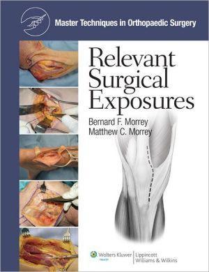 Master Techniques in Orthopaedic Surgery: Relevant Surgical Exposures - c149acec9691661892602b737c8a412f