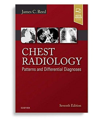 Chest Radiology: Patterns and Differential Diagnoses 7th Edition