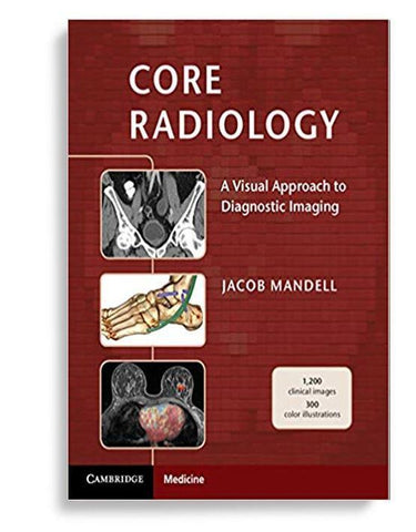Core Radiology: A Visual Approach to Diagnostic Imaging