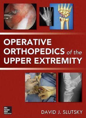 Operative Orthopedics of The Upper Extremity - d33f7e85e46be680850b1090cdc1dd1d