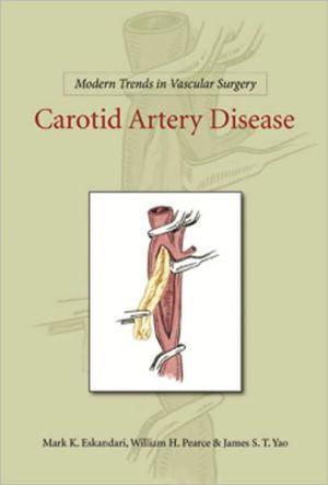 Modern Trends in Vascular Surgery: Carotid Artery Disease - d59b5c391f987ea319e74d6726efcc86