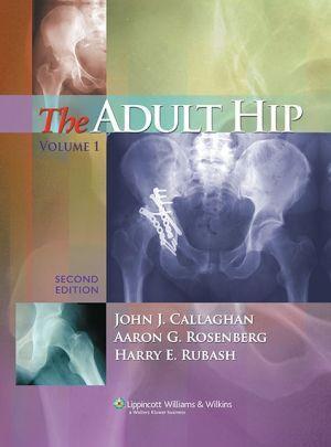 The Adult Hip, 2E 2-Vol ** - d6ae5385b731b719c338f7e50d82d71c