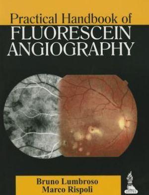 Practical Handbook of Fluorescein Angiography - d890d9c3436b72c9ab002ce92020128f