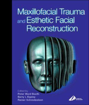 Maxillofacial Trauma and Esthetic Reconstruction ** - d9197ba551888ab55f7f9e3f162e7b74