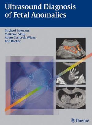 Ultrasound of Fetal Anomalies - dde35a26d63266220366b29d3755a2c7