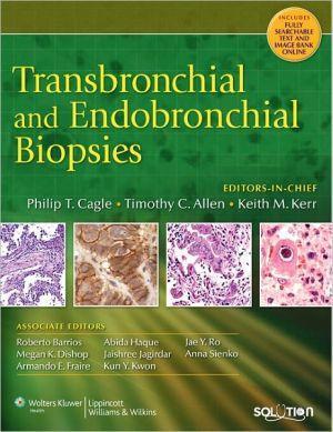 Transbronchial and Endobronchial Biopsies - dfd98f7ed16602fdc2df7834d062a4d7