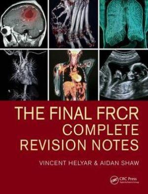 The Final FRCR: Complete Revision Notes - ebd743fbb3bb1bd00bdff438546fa2e3