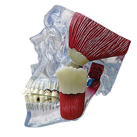 TMJ Model - Clear skull with Muscles and Ppathologies - f1398a9b4b23d801f984e275a143cc2d