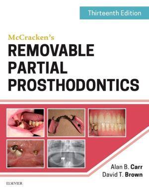 McCracken's Removable Partial Prosthodontics , 13th Edition - f2f7a8beabdb2f8e25c37873264a2ea6