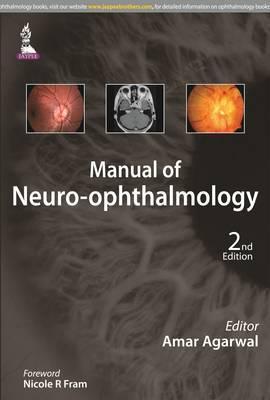 Manual of Neuro-Ophthalmology 2/e - f7e4460dff239bfab222d19ecc6ab3d6