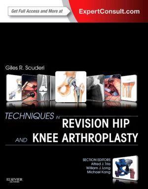 Techniques in Revision Hip and Knee Arthroplasty - fc28db10f8436a5d66e12b19b0cd584c