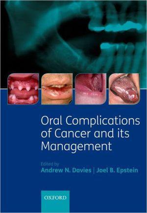 Oral Complications of Cancer and its Management - fc8fc04ac9ace5d2f12a4072b5cd0b4e
