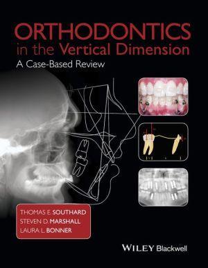 Orthodontics in the Vertical Dimension: A Case-Based Review - fdd7ecb0c7da192faf15b91c37995be8