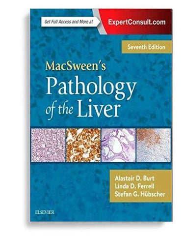 MacSween’s Pathology of the Liver 7th edition